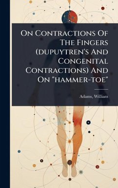 On Contractions Of The Fingers (dupuytren's And Congenital Contractions) And On 