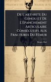 De L'arthrite Du Genou Et De L'Ã(c)panchement Articulaire ConsÃ(c)cutifs Aux Fractures Du FÃ(c)mur De L'arthrite Du Genou Et De L'Ã(c)panchement Articulaire ConsÃ(c)cutifs Aux Fractures Du FÃ(c)mur