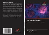 Rak jelita grubego Rak jelita grubego