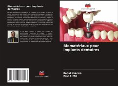 Cover Biomatériaux pour implants dentaires
