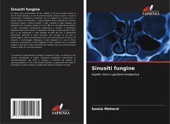 Cover Sinusiti fungine