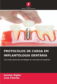 PROTOCOLOS DE CARGA EM IMPLANTOLOGIA DENTÁRIA - Dighe, Anisha;Chacko, Lisa