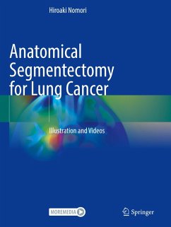 Cover Anatomical Segmentectomy for Lung Cancer