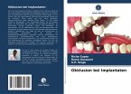 Okklusion bei Implantaten