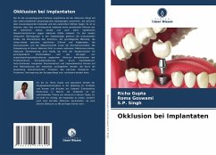 Cover Okklusion bei Implantaten