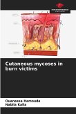 Cutaneous mycoses in burn victims Cutaneous mycoses in burn victims