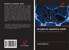 Cover Grzybicze zapalenie zatok