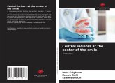 Central incisors at the center of the smile Central incisors at the center of the smile