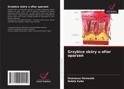 Cover Grzybice skóry u ofiar oparze¿