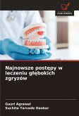 Najnowsze post¿py w leczeniu g¿¿bokich zgryzów