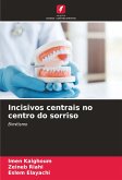 Incisivos centrais no centro do sorriso Incisivos centrais no centro do sorriso