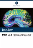 MRT und Hirnmeningiome