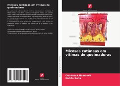 Cover Micoses cutâneas em vítimas de queimaduras