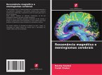 Ressonância magnética e meningiomas cerebrais