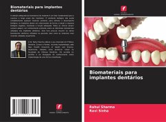 Cover Biomateriais para implantes dentários