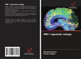 MRI i oponiaki mózgu