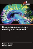 Risonanza magnetica e meningiomi cerebrali