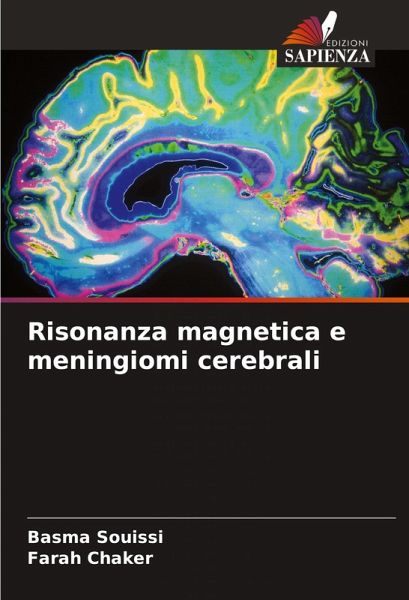 Risonanza magnetica e meningiomi cerebrali