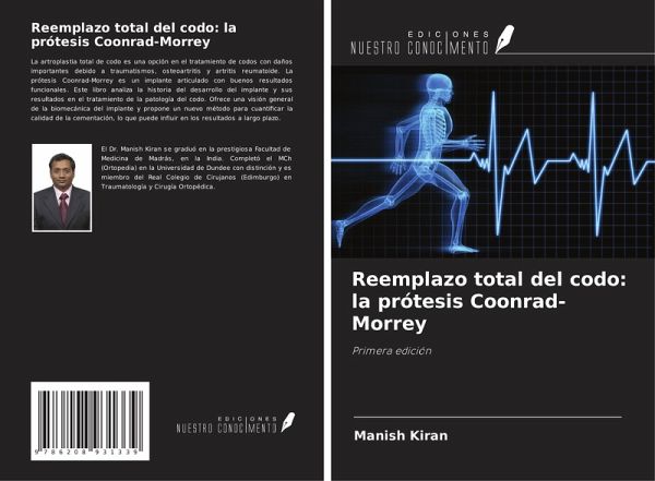 Reemplazo total del codo: la prótesis Coonrad-Morrey Reemplazo total del codo: la prótesis Coonrad-Morrey
