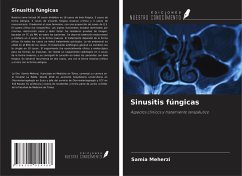 Cover Sinusitis fúngicas