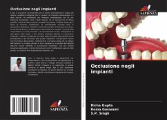 Cover Occlusione negli impianti