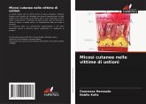 Micosi cutanee nelle vittime di ustioni Micosi cutanee nelle vittime di ustioni