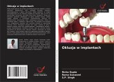 Okluzja w implantach Okluzja w implantach