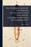 On Contractions Of The Fingers (dupuytren's And Congenital Contractions) And On 