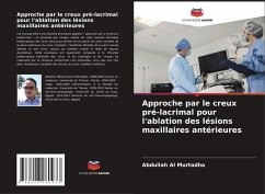 Cover Approche par le creux pré-lacrimal pour l'ablation des lésions maxillaires antérieures