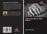 Cutis Laxa tipo II (tipo Debre) Cutis Laxa tipo II (tipo Debre)