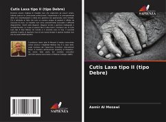 Cutis Laxa tipo II (tipo Debre) - Al Mosawi, Aamir
