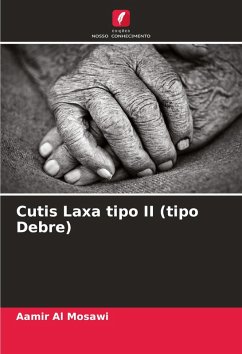 Cutis Laxa tipo II (tipo Debre) - Al Mosawi, Aamir