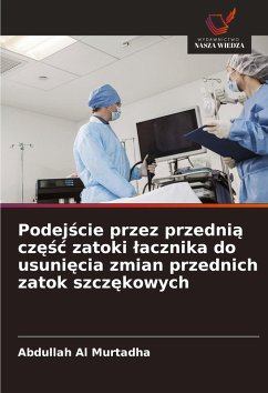 Podej¿cie przez przedni¿ cz¿¿¿ zatoki ¿acznika do usuni¿cia zmian przednich zatok szcz¿kowych - Al Murtadha, Abdullah