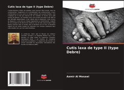 Cutis laxa de type II (type Debre) - Al Mosawi, Aamir