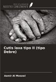 Cutis laxa tipo II (tipo Debre) Cutis laxa tipo II (tipo Debre)