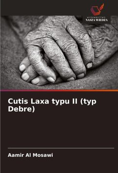 Cutis Laxa typu II (typ Debre) - Al Mosawi, Aamir