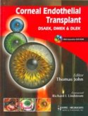 Corneal Endothelial Transplant DSEAK, DMEK and DLEK Corneal Endothelial Transplant DSEAK, DMEK and DLEK