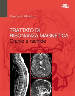 Trattato di risonanza magnetica. Cranio e rachide - Dal Pozzo, Giancarlo