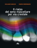 Il rialzo del seno mascellare per via crestale Il rialzo del seno mascellare per via crestale