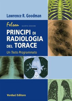 Felson. Principi di radiologia del torace. Un testo programmato - Goodman, Lawrence R.