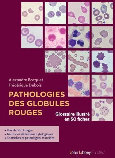 Pathologies des globules rouges (eBook, ePUB) Pathologies des globules rouges (eBook, ePUB)