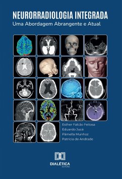 Neurorradiologia Integrada (eBook, ePUB) Cover Neurorradiologia Integrada (eBook, ePUB)
