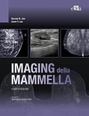 Imaging della mammella Imaging della mammella