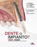 Dente o impianto? Il recupero o la sostituzione del dente naturale gravemente compromesso Dente o impianto? Il recupero o la sostituzione del dente naturale gravemente compromesso
