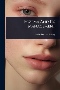 Cover Eczema And Its Management