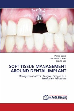 Cover SOFT TISSUE MANAGEMENT AROUND DENTAL IMPLANT
