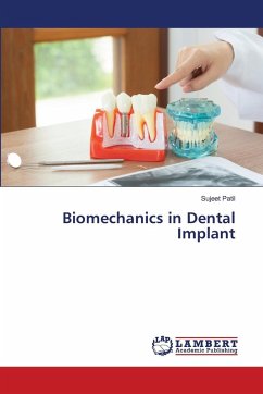 Cover Biomechanics in Dental Implant