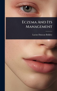 Cover Eczema And Its Management