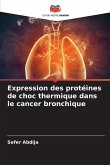 Expression des protéines de choc thermique dans le cancer bronchique Expression des protéines de choc thermique dans le cancer bronchique