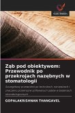 Z¿b pod obiektywem: Przewodnik po przekrojach naz¿bnych w stomatologii